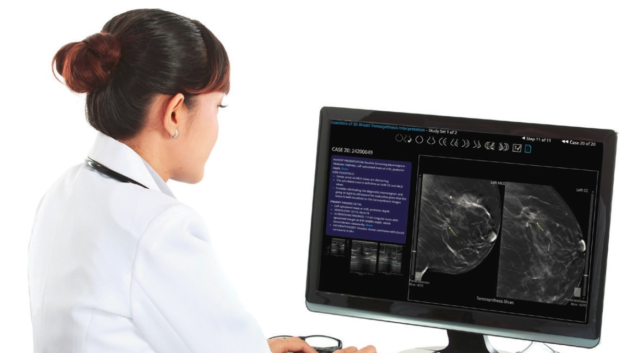 3D Breast Tomosynthesis Interpretation